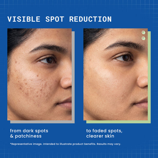DermDoc 10% Vitamin C Brightening Face Serum - image 2
