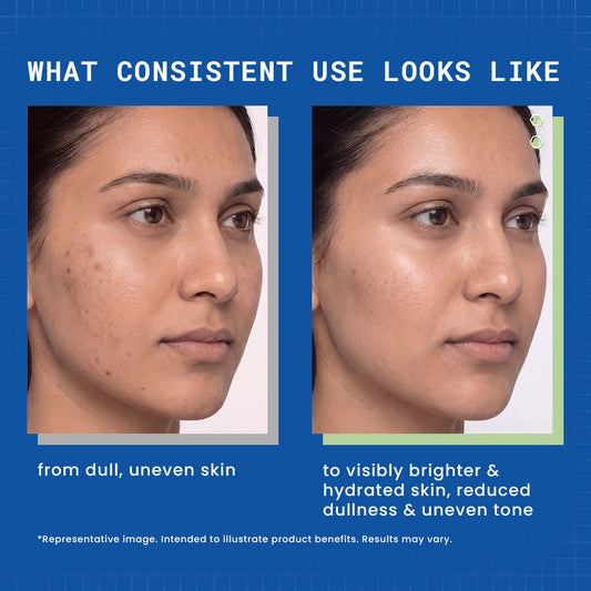 DermDoc 10% Vitamin C Gel Capsule Brightening Night Cream - image 2