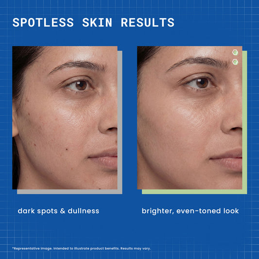 DermDoc 2% Kojic Acid Face Serum - image 2