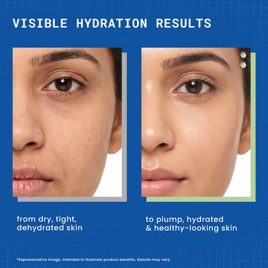 DermDoc Hya Hydrate 1% Hyaluronic Acid Oil-Free Face Moisturiser - image 2