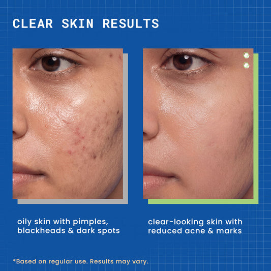 DermDoc 2% Salicylic Acid Face Wash (120 ml) - image 2