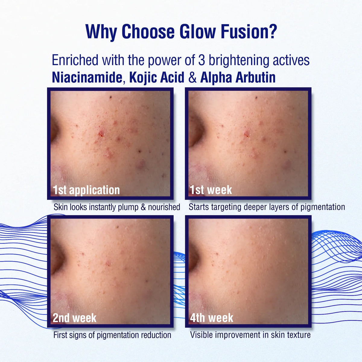 DermDoc x NY Bae Glass Skin Glow Combo Kit - image 5