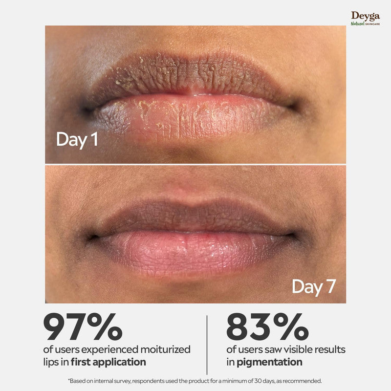 Deyga Beetroot Lip Balm – Classic