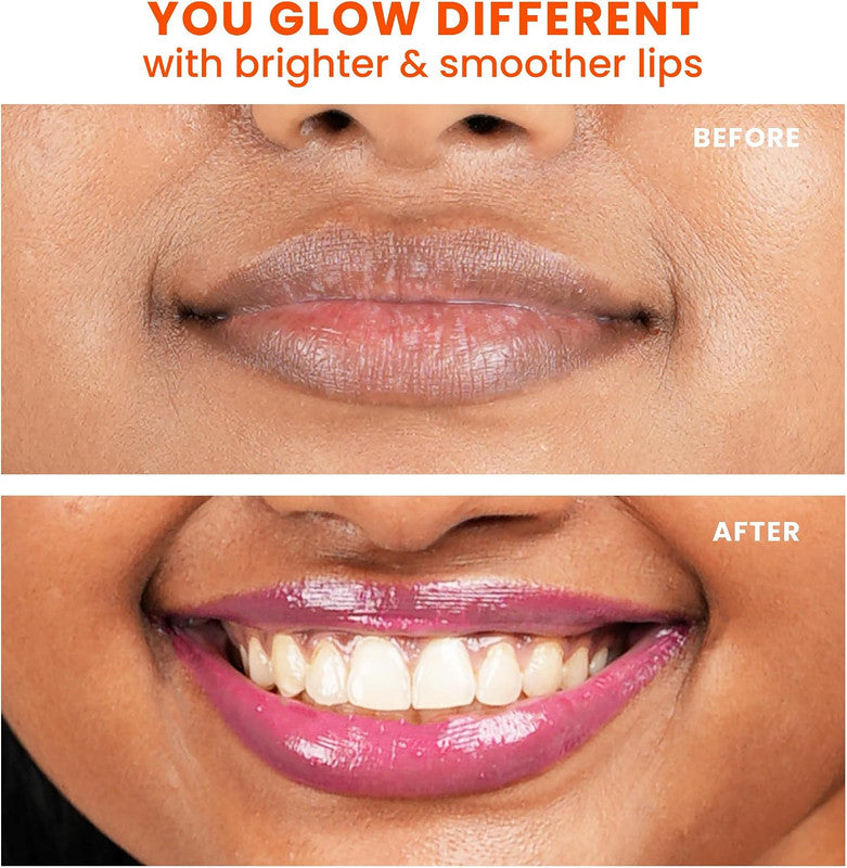Foxtale Glazed Lips Brightening Lip Balm – Pink Glaze – 12g