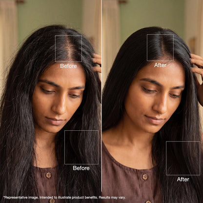 Alps Goodness Hair Growth & Frizz Control Duo – Rosemary Leaves 100 gm - image 3