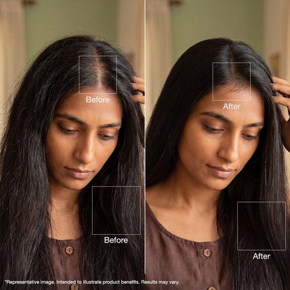 Alps Goodness Rosemary Hair Growth Ritual Kit – Powered With the Goodness of Rosemary & Flaxseed - image 5
