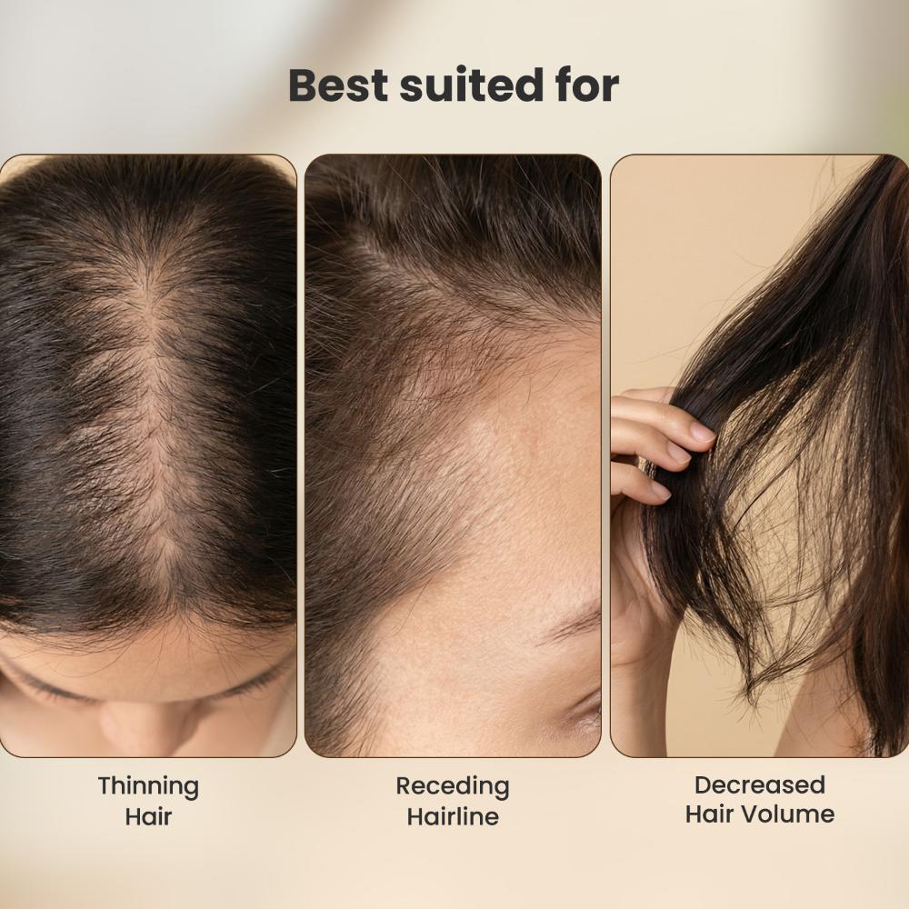 Alps Goodness Hair Regrowth Kit – Rosemary Water (100 ml) + 0.5 mm Derma Roller with 540 Titanium Alloy Needles - image 5