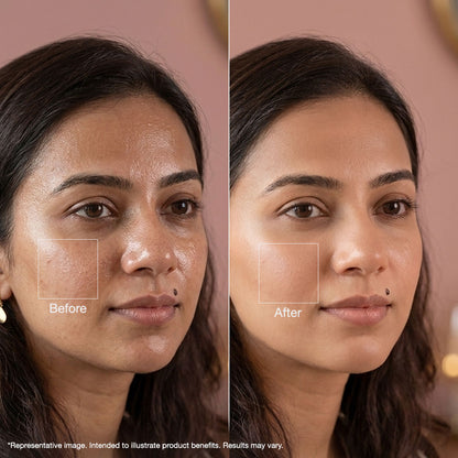 Alps Goodness Powder – Multani Mitti (50 gm) - image 3