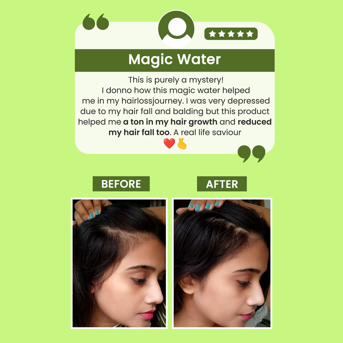 Alps Goodness Thick & Frizz-Free Hair Duo with Rosemary Water Spray (100 ml) & Flaxseed Gel (300 ml) – For Thick-Long Hair - image 3