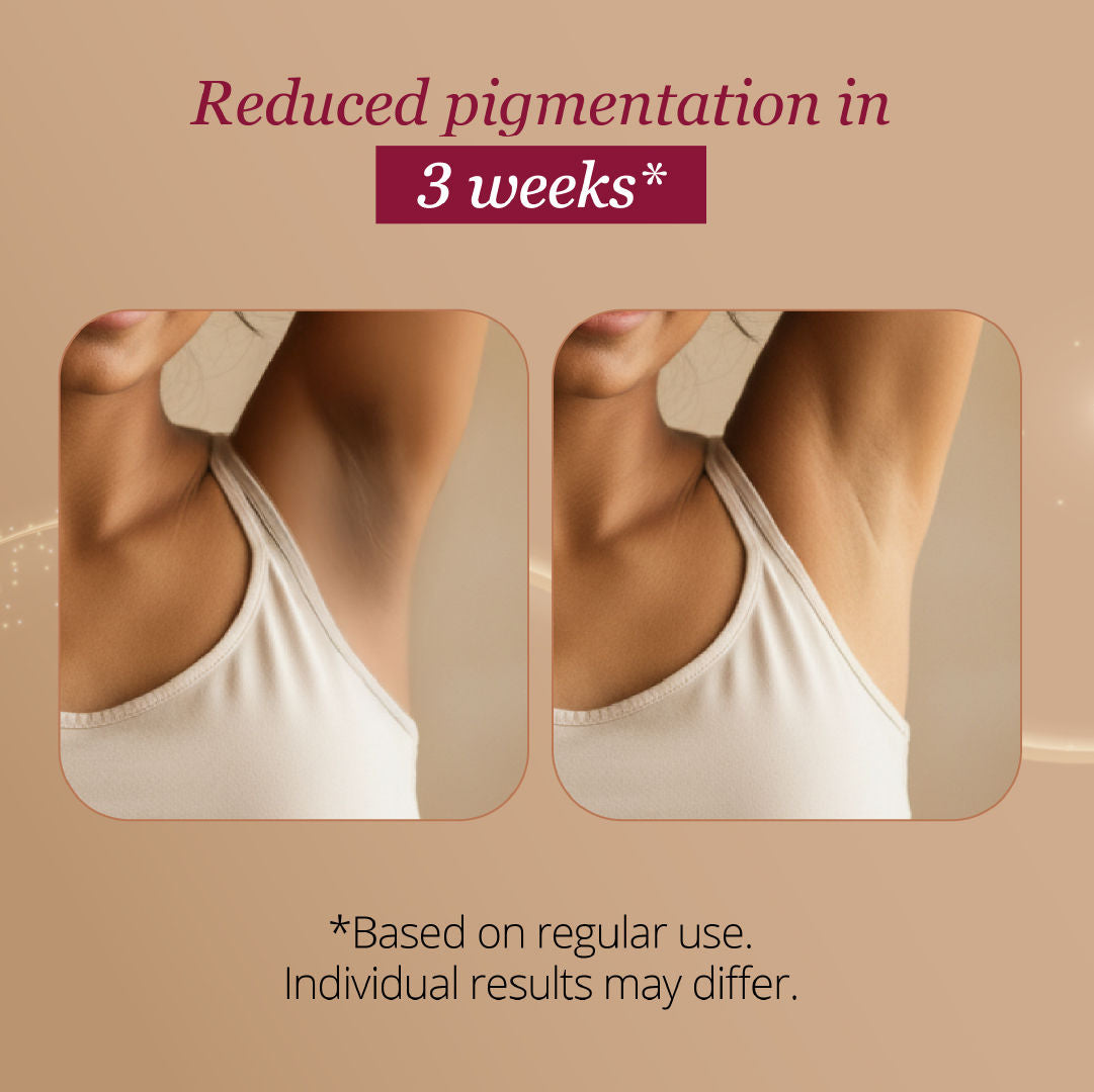 Carmesi Restore Underarm Spray With 5% Glycolic Acid, 120 ml - image 4
