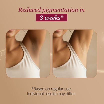 Carmesi Restore Underarm Spray With 5% Glycolic Acid, 120 ml - image 4
