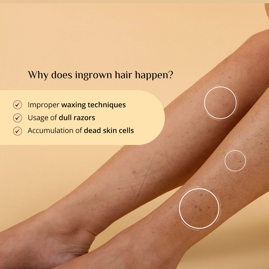 Carmesi Ingrown Relief Body Serum - image 4