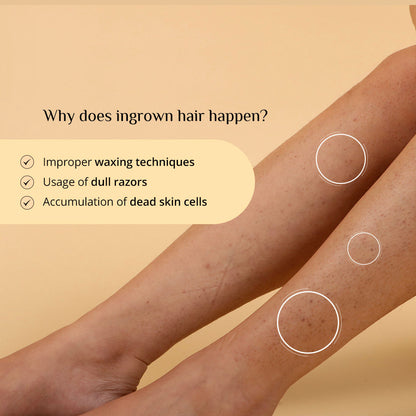 Carmesi Ingrown Relief Body Serum - image 4