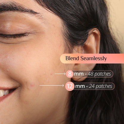 Carmesi Pimple Patch For Face - image 4