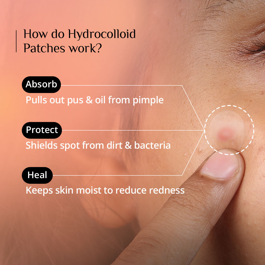 Carmesi Pimple Patch For Face - image 5