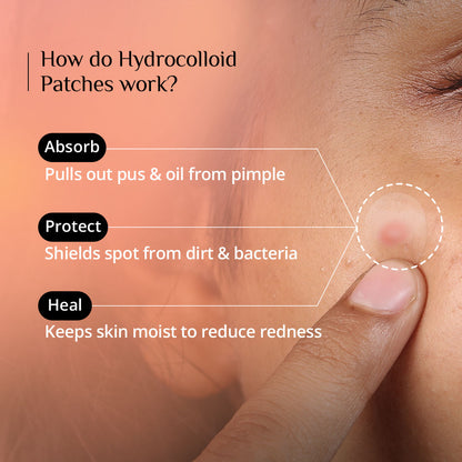Carmesi Pimple Patch For Face - image 5