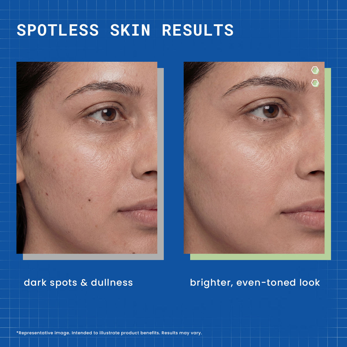 DermDoc 2% Kojic Acid Face Serum - image 2