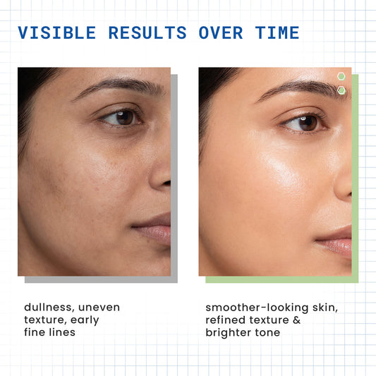 DermDoc 2% Retinol Complex Face Serum with Niacinamide & Hyaluronic Acid - image 2
