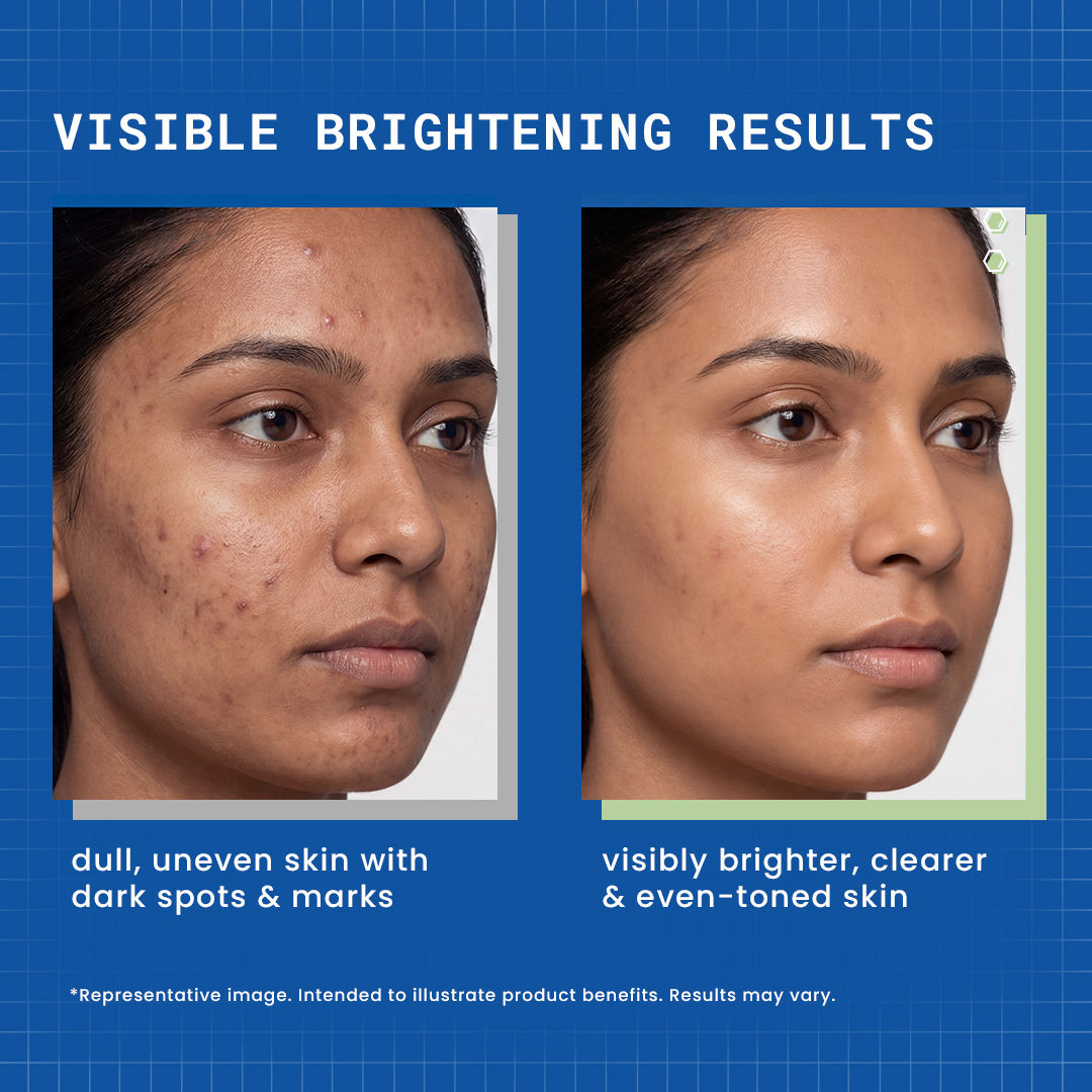 DermDoc Complete Niacinamide Skincare Routine Kit - image 3