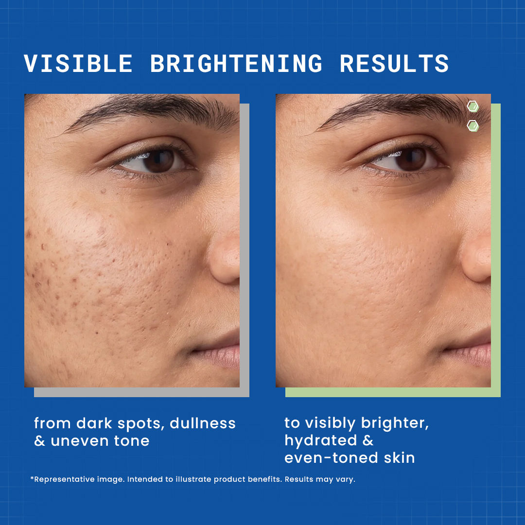 DermDoc Day & Night Brightening Duo - image 3