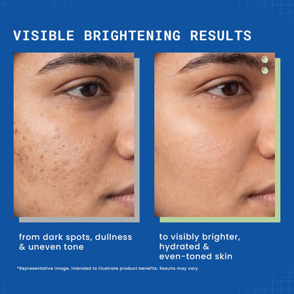 DermDoc Day & Night Brightening Duo - image 3