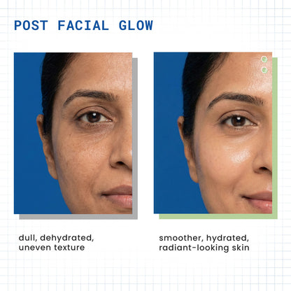 DermDoc HydraGlow 5-Step Hydrating Facial Kit - image 2