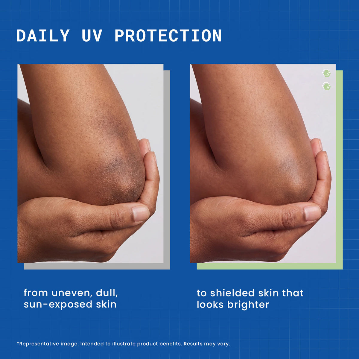 DermDoc 4% Nia Shield Body Sunscreen Lotion SPF 30 PA+++ - image 2