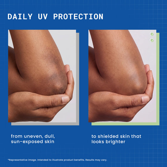 DermDoc 4% Nia Shield Body Sunscreen Lotion SPF 30 PA+++ - image 2