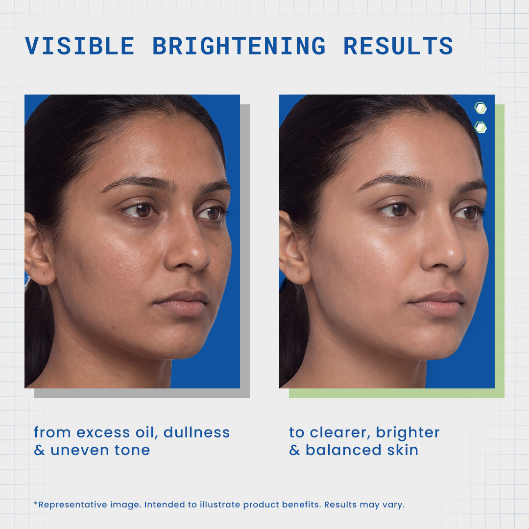DermDoc Niacinamide Brightening Kit - image 4