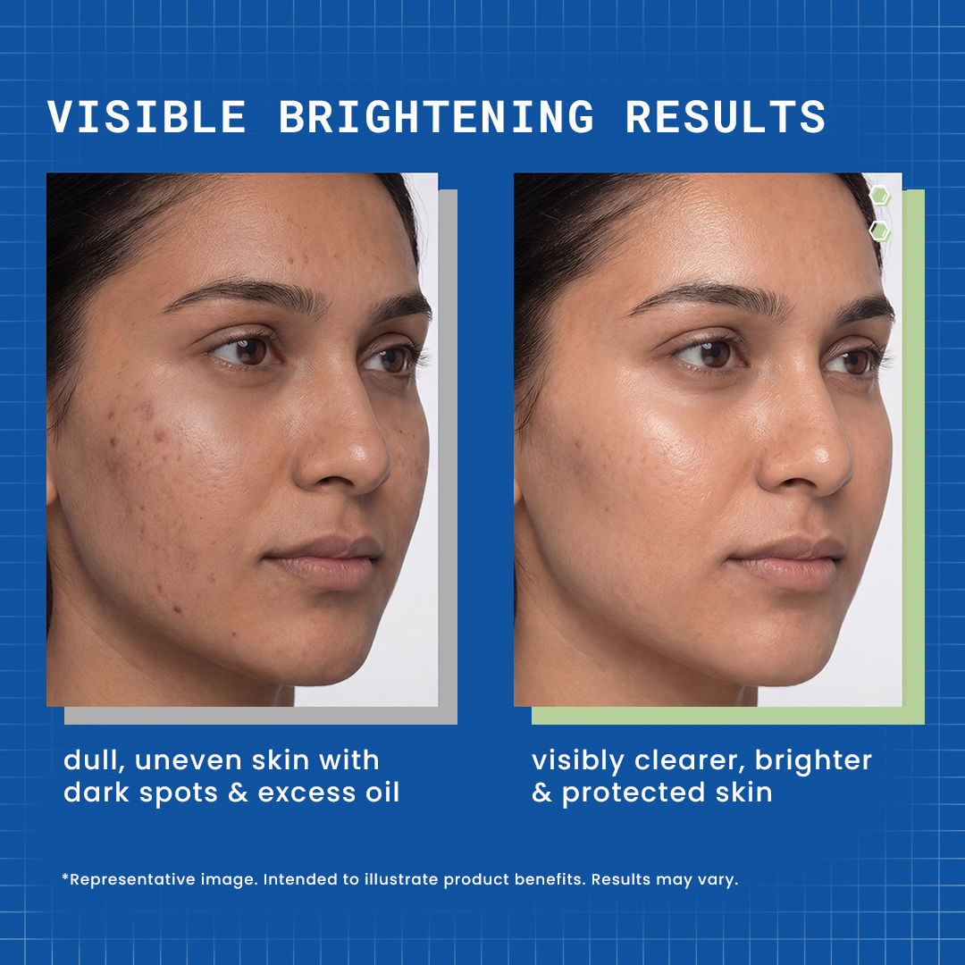 DermDoc Niacinamide CSMS Routine Combo - image 3