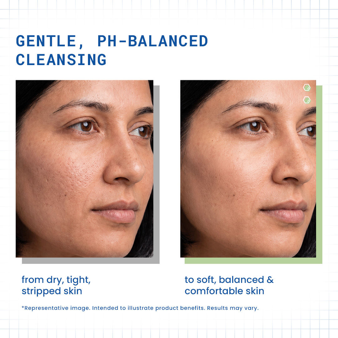 DermDoc Pro-Vitamin B5 pH 5.5 Gentle Facial Wash - image 2