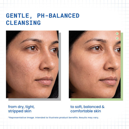 DermDoc Pro-Vitamin B5 pH 5.5 Gentle Facial Wash - image 2
