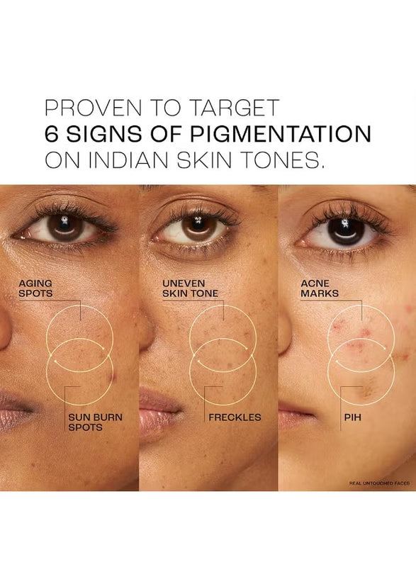 Lakmé Perfect Radiance Pigmentation Treatment Gel with 10% Niacinamide & Resorcinol Complex