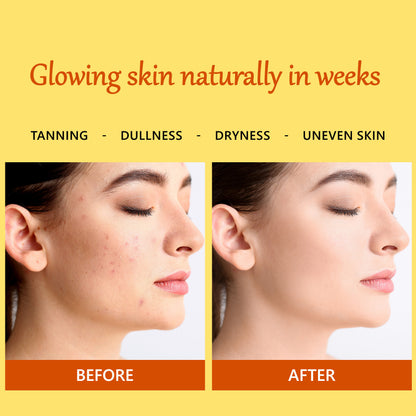 Good Vibes Ubtan De-Tan Glow Day Cream SPF30 | Tan free, Brightening, Depigmentation (50 gm) - Good Vibes image 2